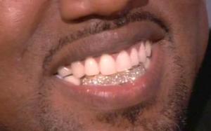 kayne diamond mouth